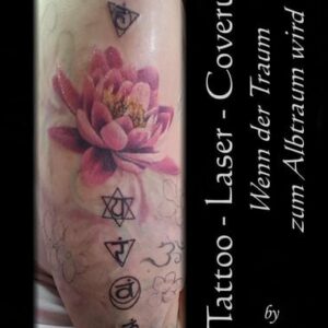 Tattoo - Laser - Cover Up